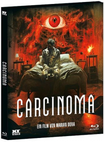 Carcinoma (Blu-ray Disc)