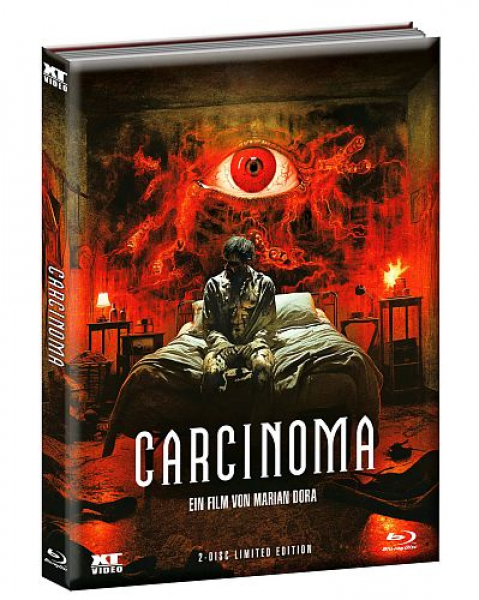 Carcinoma - Limited Uncut 500 Edition (DVD+Blu-ray Disc) - Wattiertes Mediabook - Cover B