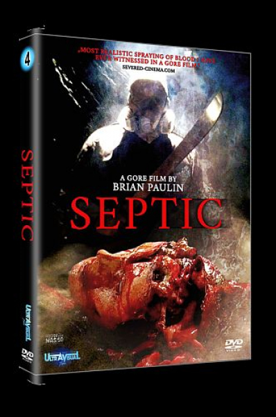 Septic