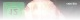 Coma